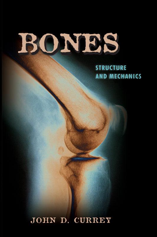 Bones