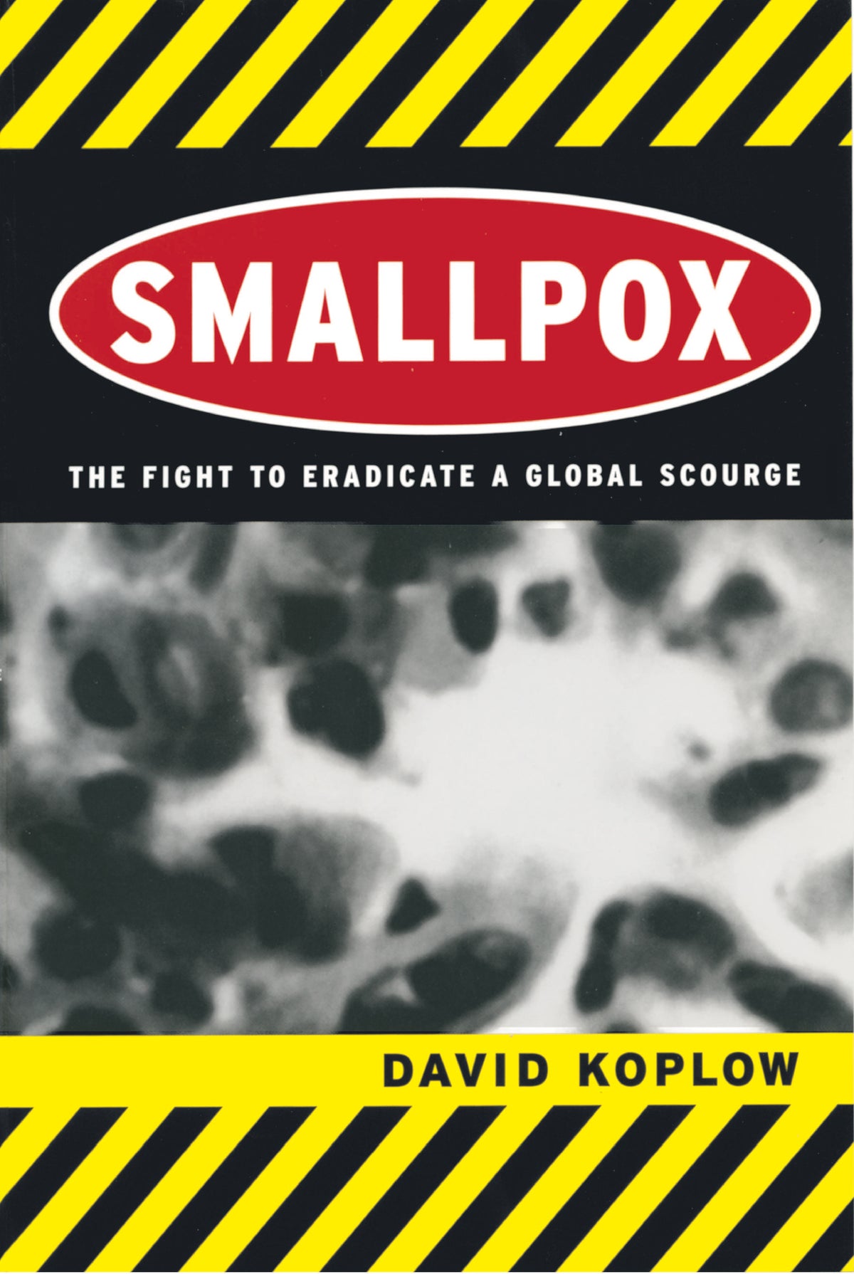 Smallpox